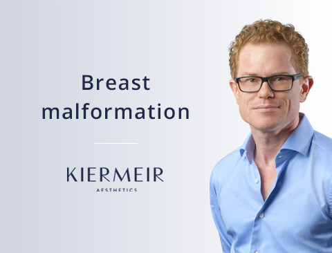Breast Malformation in Bern by Dr. Kiermeir 